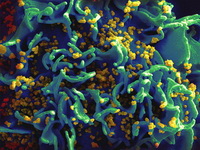 hiv_infected_cell_s