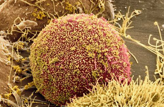 Cell infected with HIV, SEM