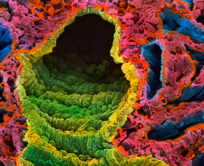 легочная ткань, электронная микроскопия 