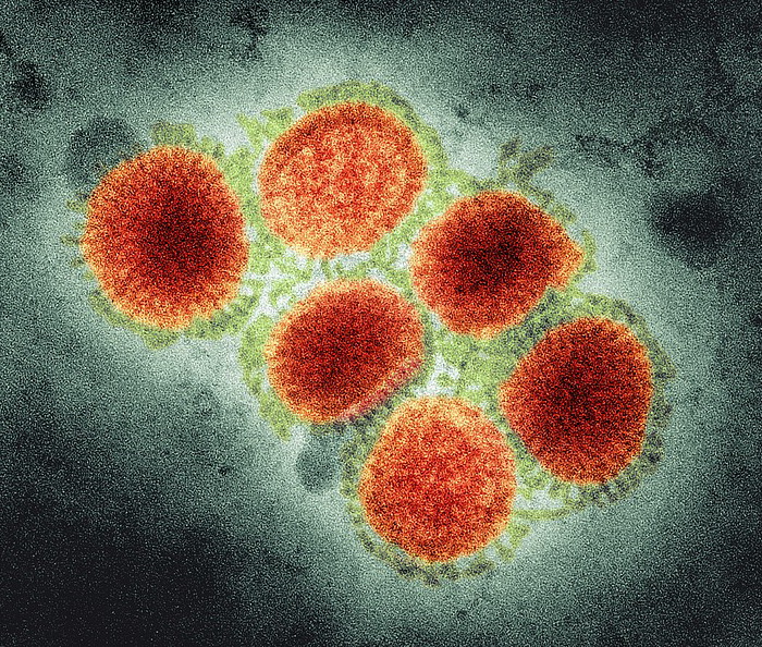 h1n1-swine-flu-virus-tem1