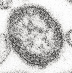 Measles_virus_opt